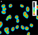 bunte fluoreszenzmikroskopische Bilder der Bakterien als runde und ovale Punkte.