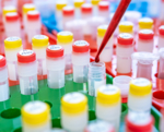 A laboratory environment with numerous sample tubes with yellow and red caps.