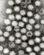 Black and white electron microscope image of some virus particles.