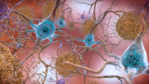 Darstellung mehrerer Neuronen mit langen Zellfortsätzen, zwischen denen sich kugelförmige Beta-Amyloid-Aggregate befinden. Die  Zellkörper sind von pTau-Fibrillen durchzogen.