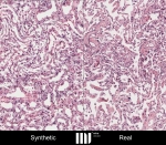 Two reddish-coloured tissue sections with blue cell nuclei can be seen.